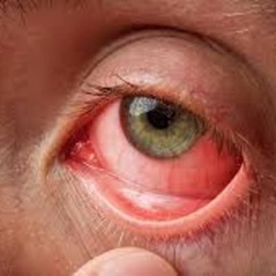 Eye Specific