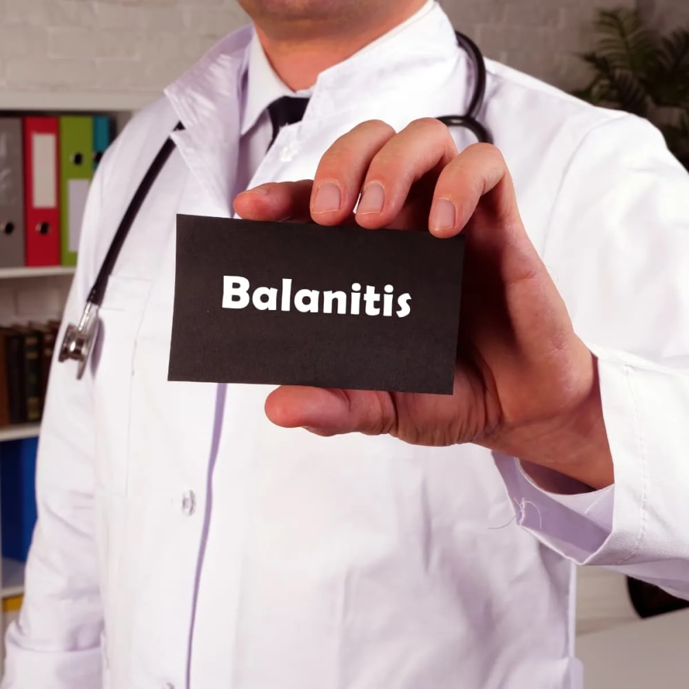 Balanitis
