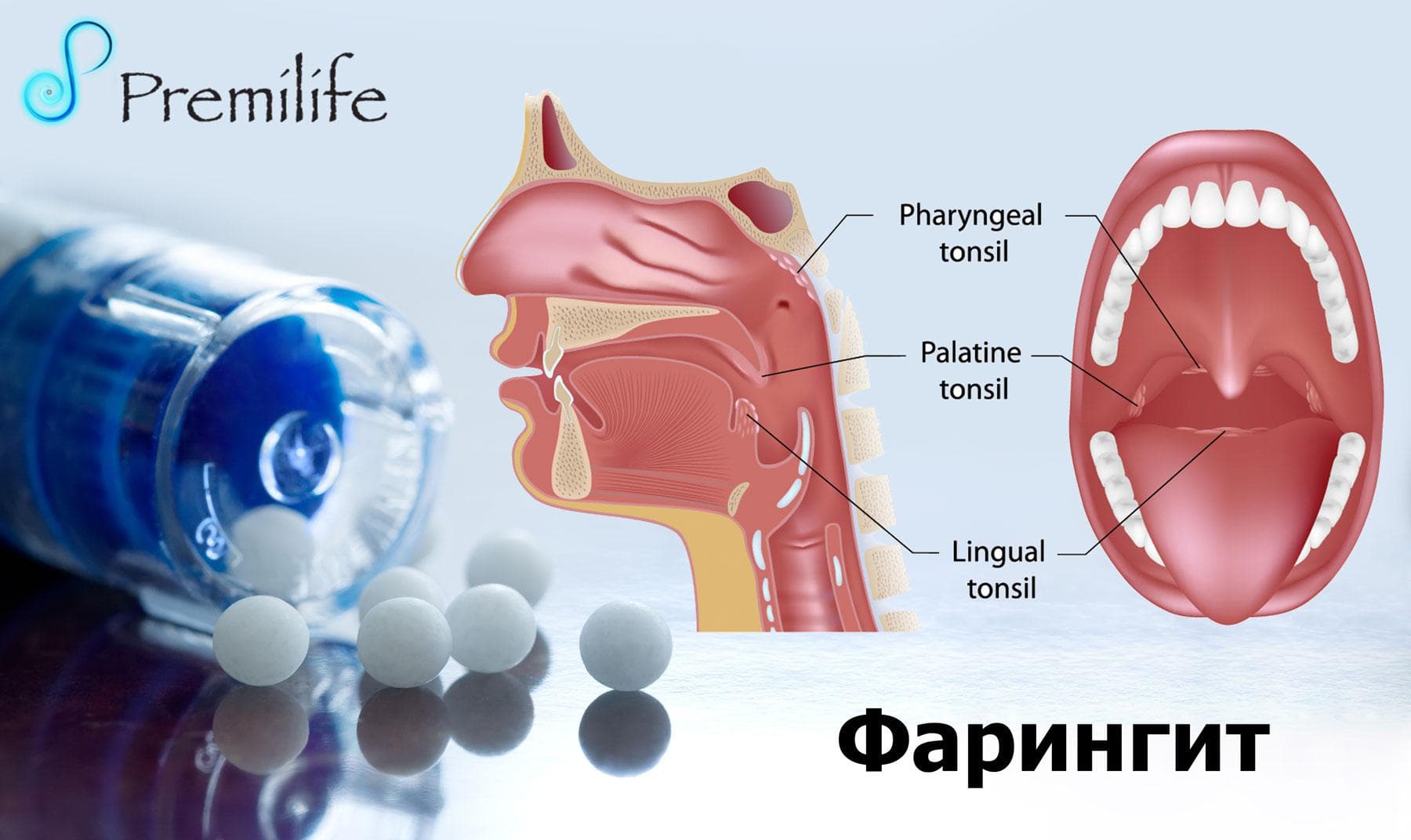 Лечение фарингита у взрослых