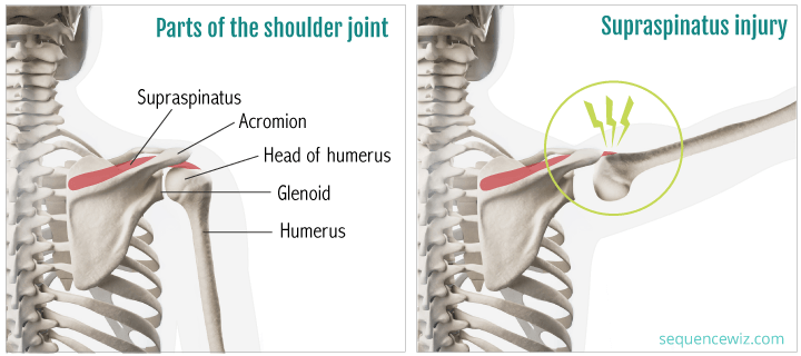 Lifting your arm without spreading your wings can pinch your supraspinatus tendon.