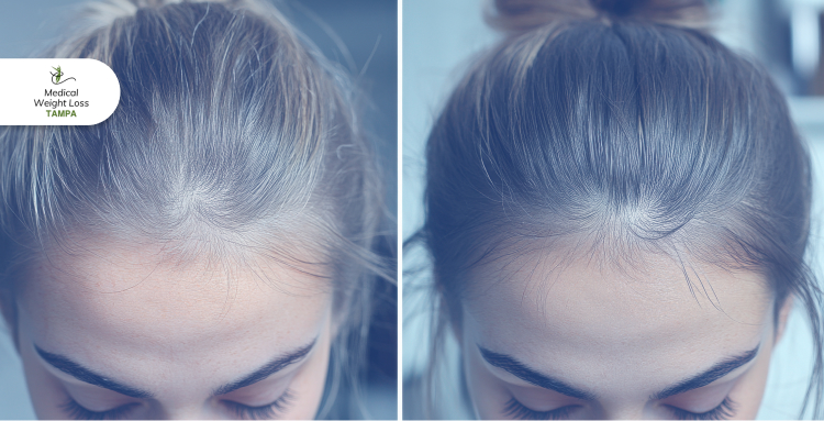 Why We Need Ongoing PRP Maintenance for Long Growth Why We Need Ongoing PRP Maintenance for Long Growth