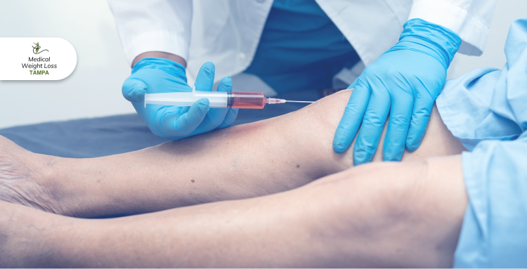 Can PRP Help with Muscle Tears While You're Losing Weight?