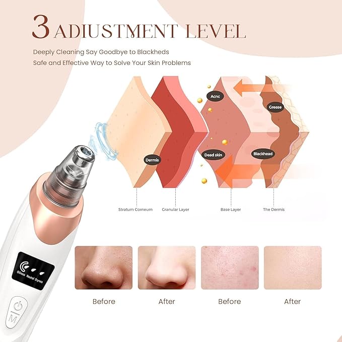 5-in-1 Blackhead Remover Machine 5