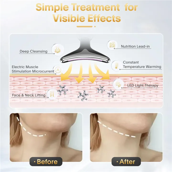 Anti Wrinkles Face Massager - Free Shipping 4