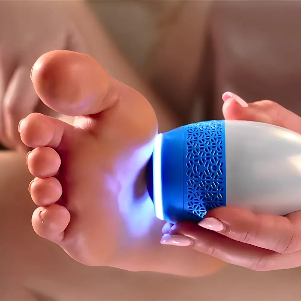ELECTRIC FOOT CALLUS REMOVER 2