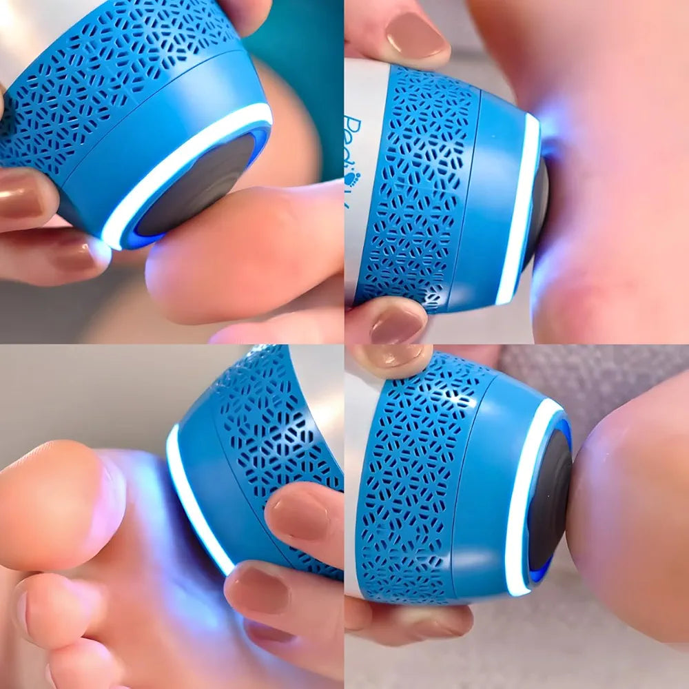 ELECTRIC FOOT CALLUS REMOVER 3