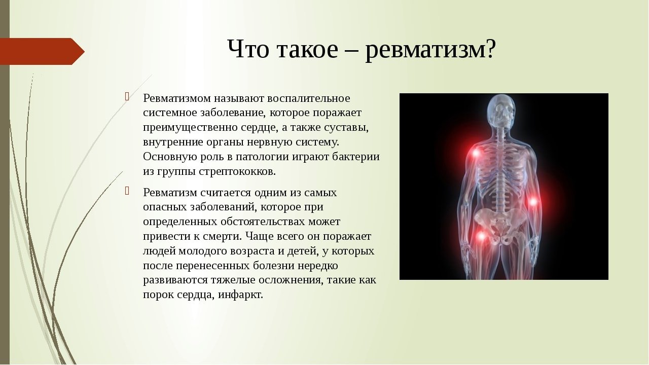 Ревматизм что. Ревматизм суставной формы. Ревматические заболевания что это такое симптомы. Ревматизм поражение суставов.