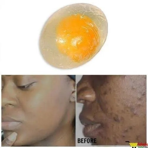 collagen-beauty-egg-soap-for-pimples-sun-burn-and-anti-ageing-80g-1721306942