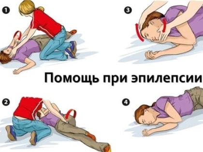 Эпилепсия: первая помощь при приступе