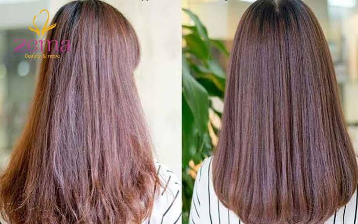 Phục hồi collagen