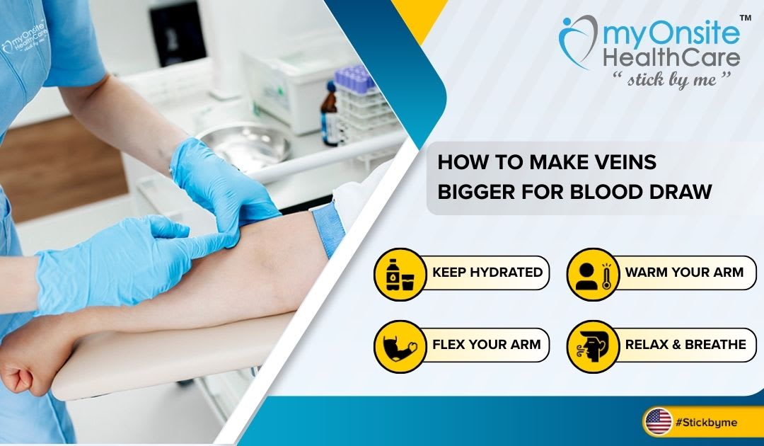 Blood Draw Def How to Make Veins More Plump: Easy Tips for Enhanced Vascular Definition