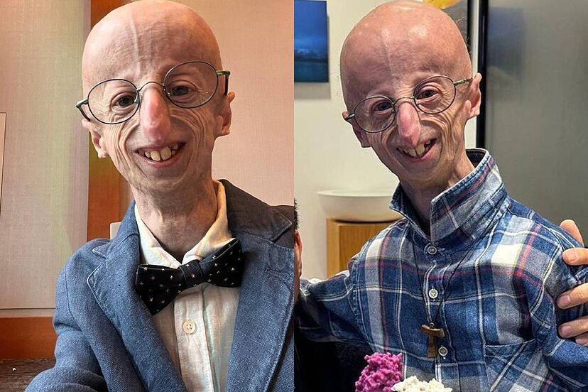 Muere Sammy Basso a los 28 años, la persona con progeria más longeva del mundo