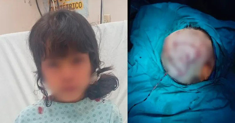 Niña atacada por su propio perro evoluciona; decidirán dormir al can