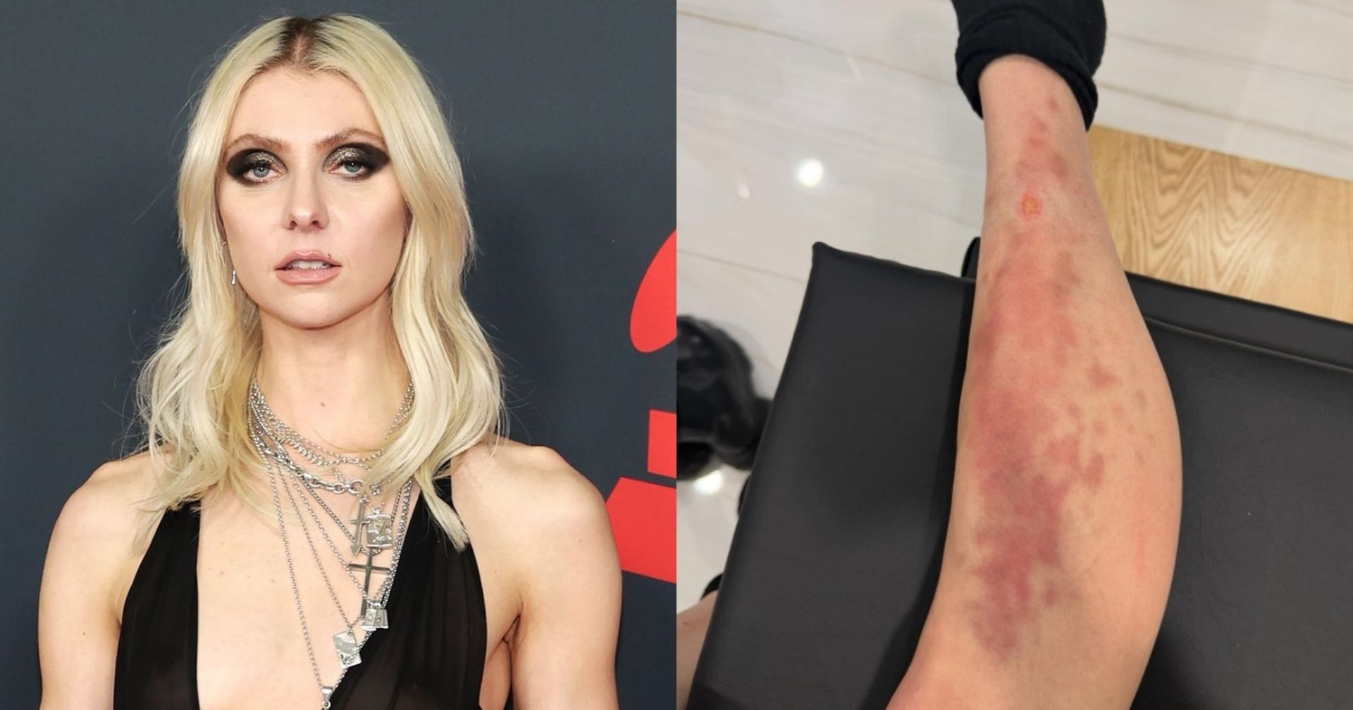 Taylor Momsen es hospitalizada tras picadura de araña en CdMX