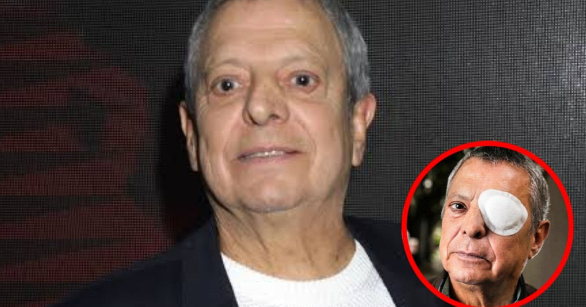 Desmienten que César Bono haya perdido un ojo tras supuesta cirugía