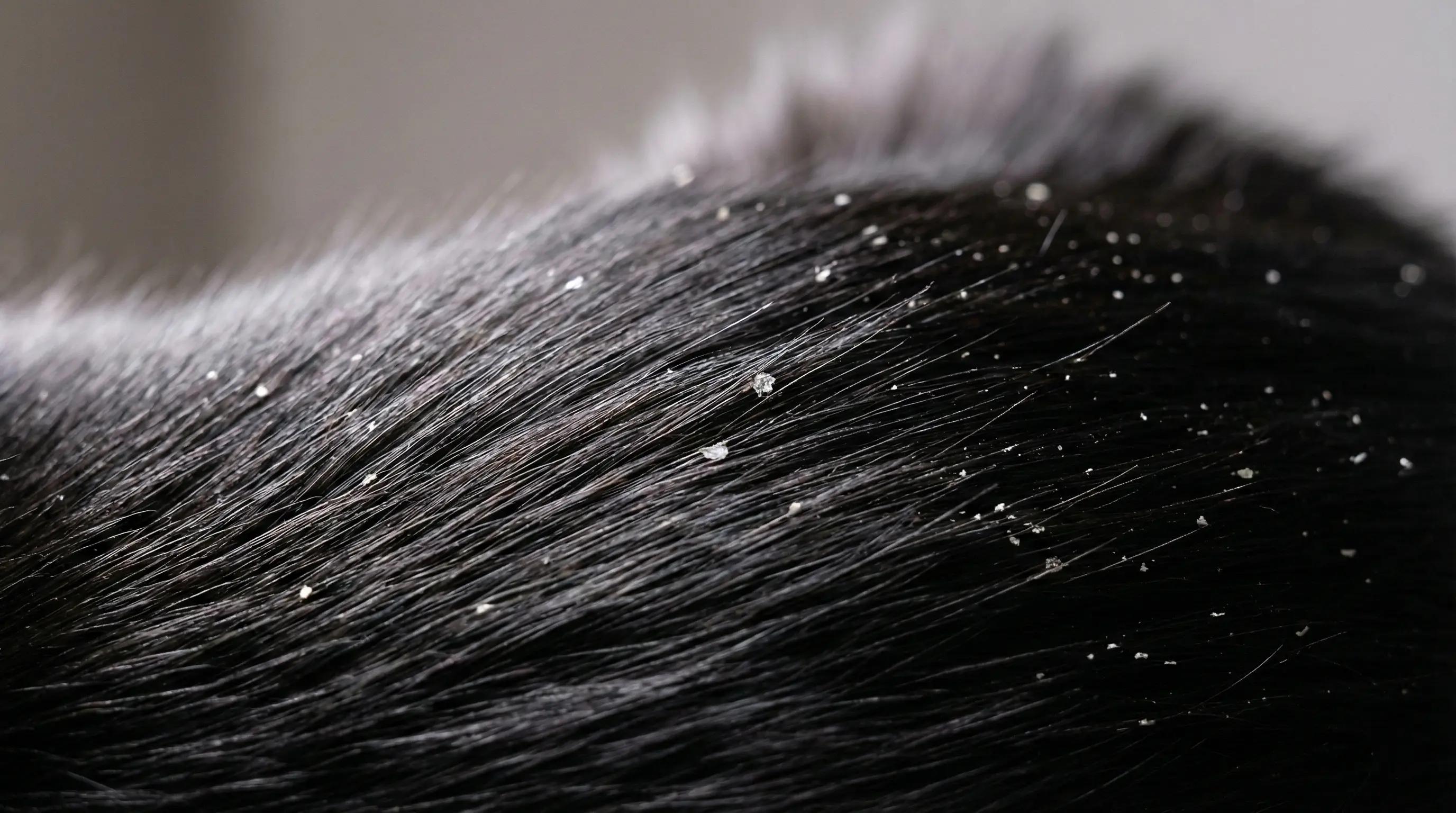 Close up of dandruff flakes on dark cat fur