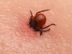 В Ивановской области зарегистрировано 15 случаев укусов клещей