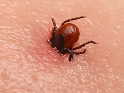 В Ивановской области зарегистрировано 15 случаев укусов клещей