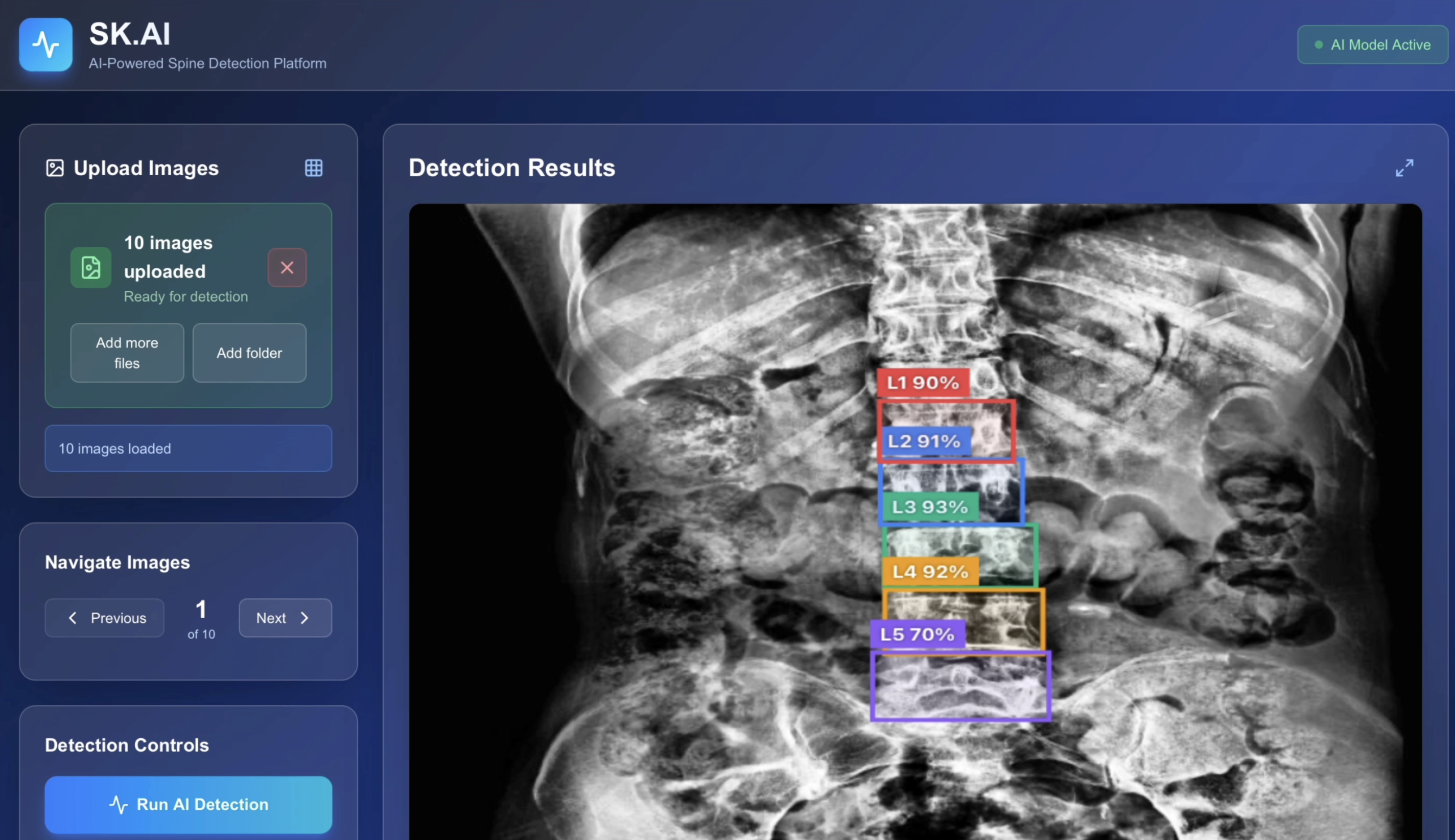 Medical imaging with AI-powered spine detection