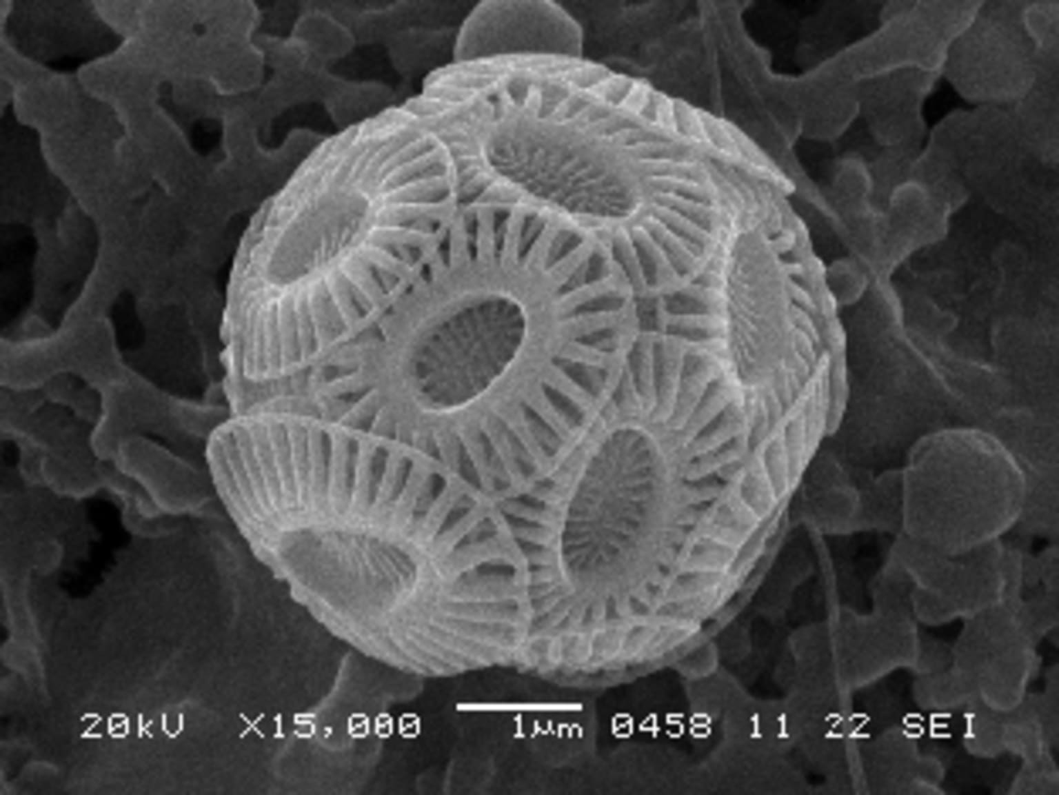Scanning Electron Microsope image of Emiliana species.