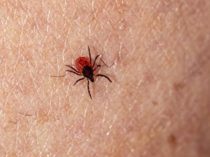 Клещи продолжили охоту в Карелии