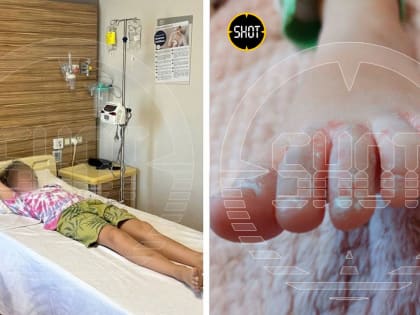 Симптомы вируса Коксаки: на что обратить внимание