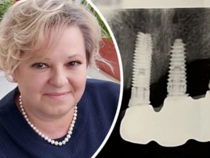 «Каждое утро гной с ладошку»: у женщины четыре года гниет челюсть после посещения стоматолога