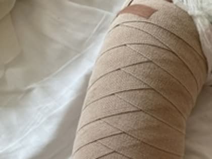 Маленькому Леше нужна помощь