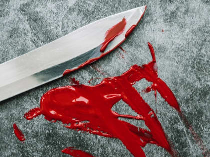 Жительница Карелии получила ножевое ранение из-за ревности