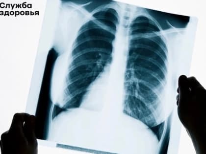 Жителей Карелии пригласили пройти флюорографию