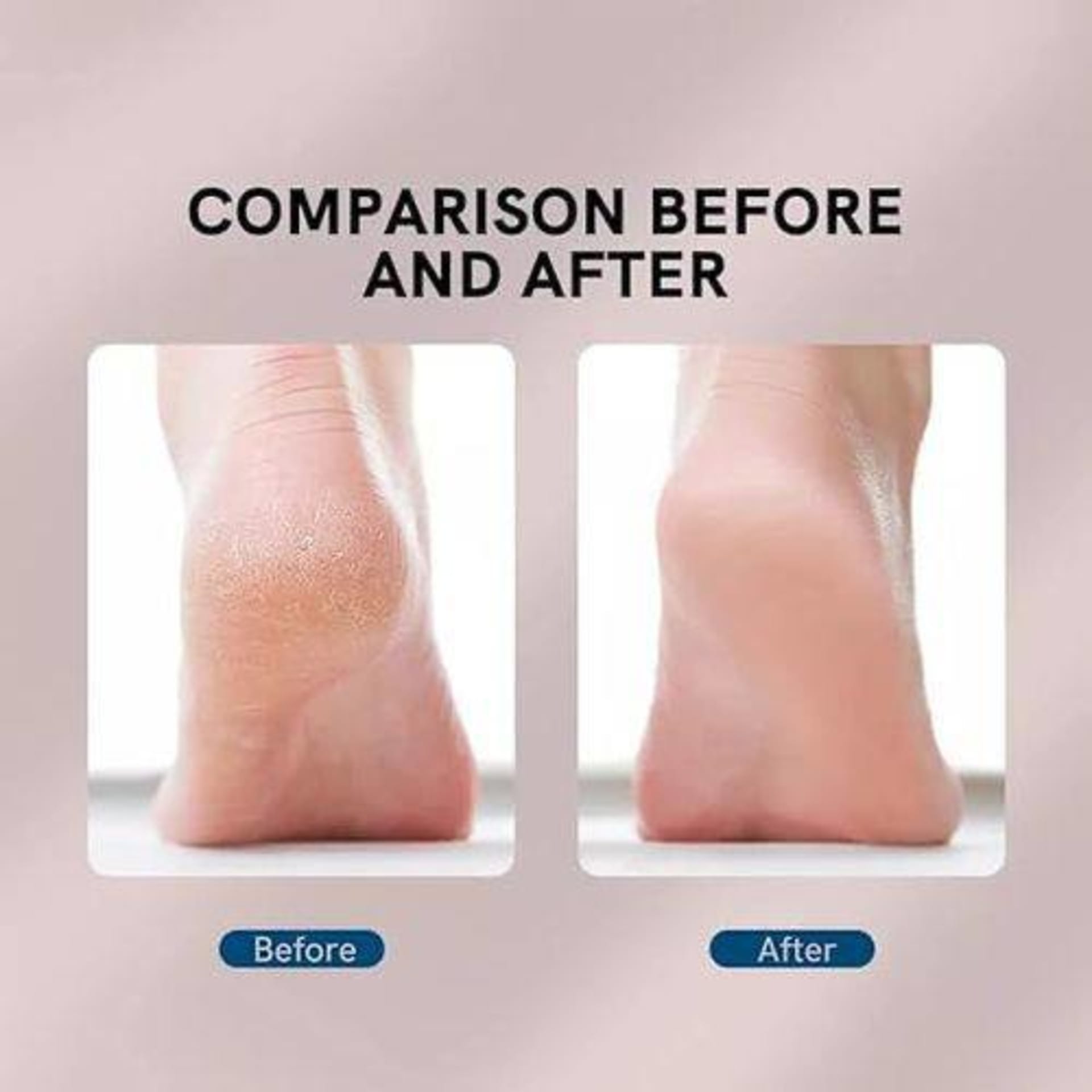 Ponceuse et lisseuse électrique pour les pieds 3