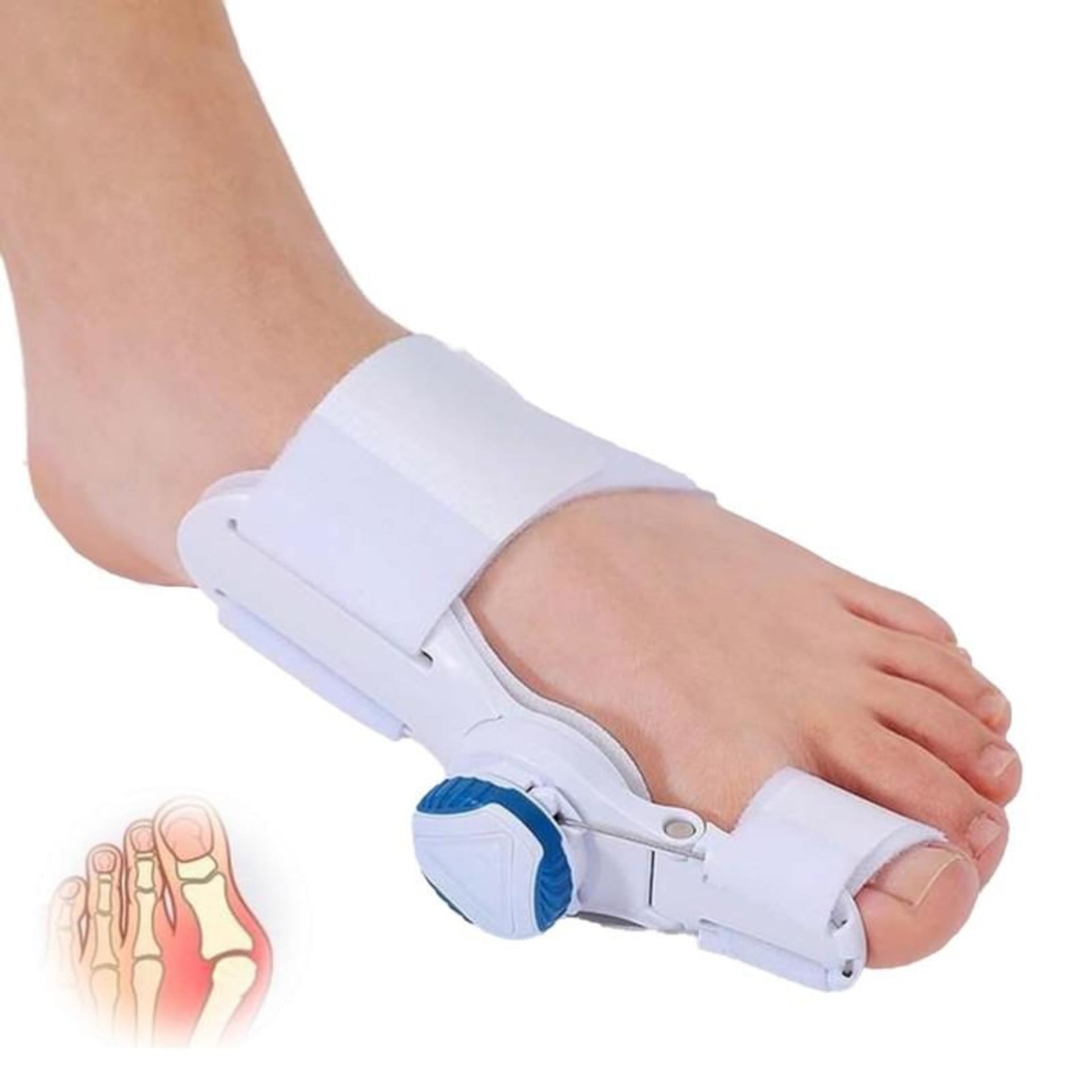 Correcteur d'oignon (Bunion Corrector) 6