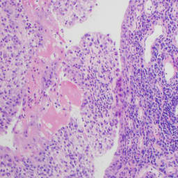 Long-Term Inflammation Support