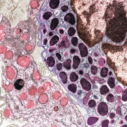 Mast Cell Support