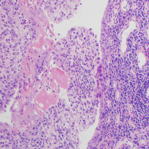 Long-Term Inflammation Support