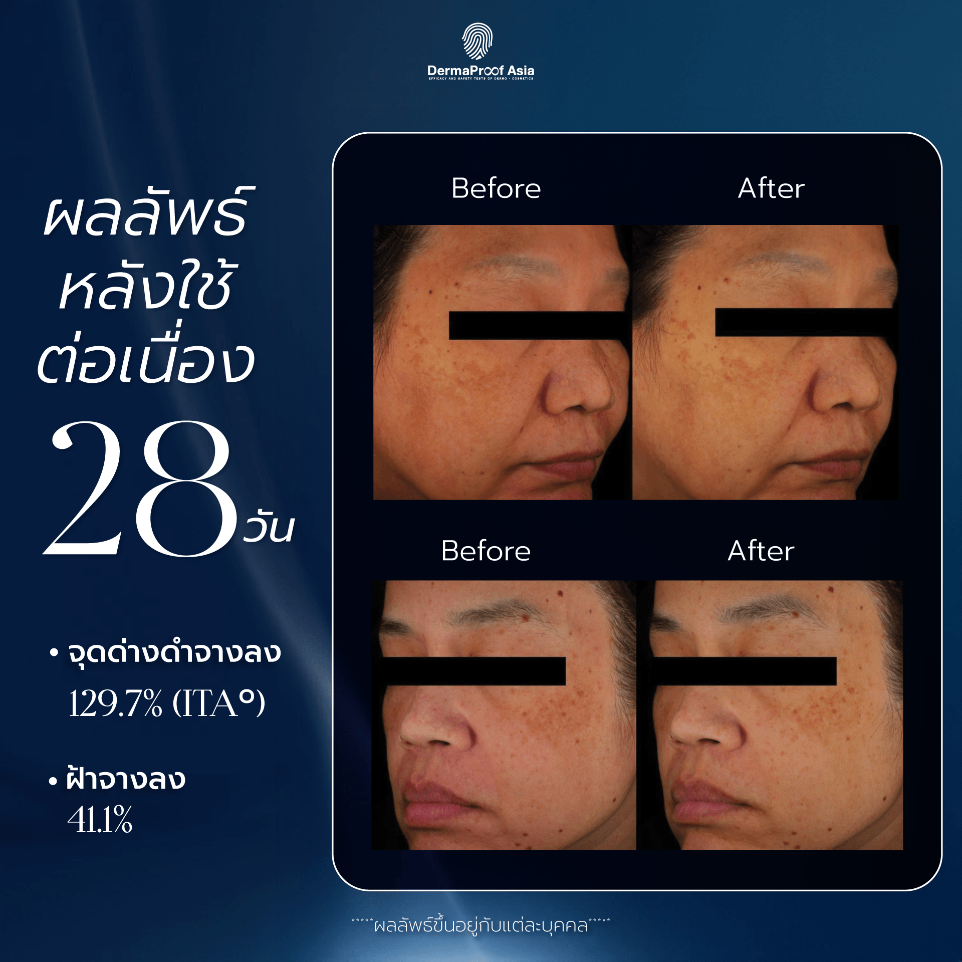 ผลลัพธ์หลังใช้ 28 วัน