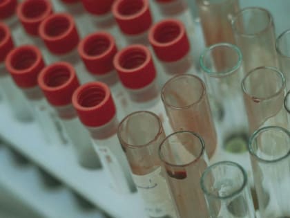 Проблемы концентрации: как справиться с рассеянным вниманием