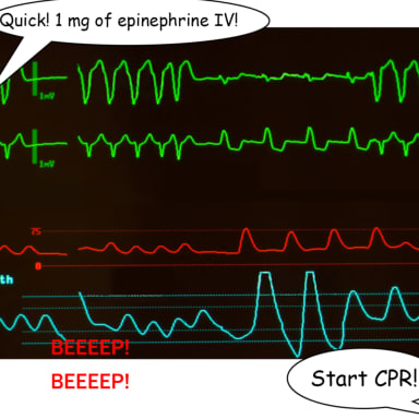 Episode-9: - Gravity Falls Don't you die on me CONTINUATION PART 8 of Gravity Falls: Don't you die on me comic, a Gravity Falls fanfiction comic. Courtney and Stanley are talking in the hospital corridor, Stanley at some point realizes that despite all the years of fighting to get the Ford back, everything has suddenly collapsed like a house of cards. He is aware that their joint plans to sail the boat around the world may now not come to fruition at all.After the tests, Stanford is brought back to the room, and the doctor, after Stanley's requests, agrees to let Courtney in to stay with Stanford for a while. The doctor informs Stanley that his brother has been put into a medically induced coma due to his severe injuries and that it is not known when he will wake up from it. Courtney is distraught, asking her unconscious loved one to fight and not leave her. She apologizes to him for the earlier argument, realizing that she may not have the opportunity to talk to him again. The moment of peace is interrupted by Stanford's heart stopping again. The doctors begin resuscitation. Will there be a chance for a miracle in such a tragic situation?