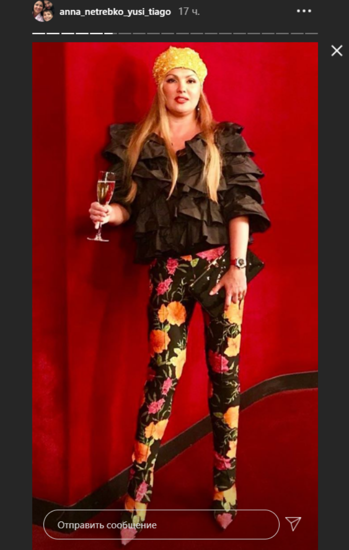 Анна Нетребко. Фото