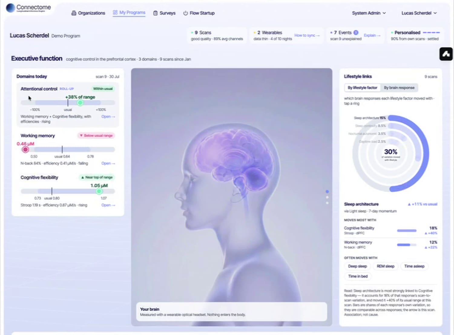 Connectome dashboard showing brain measures against a usual range