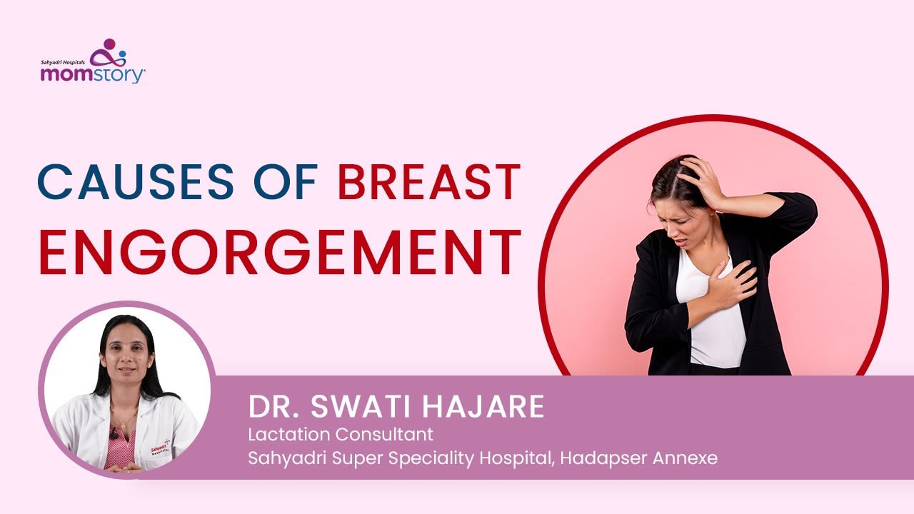 breast engorgement