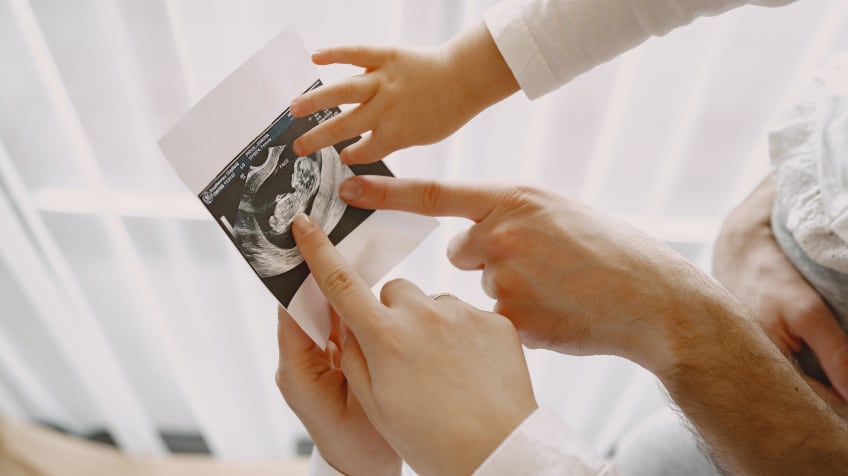 Pregnancy scan