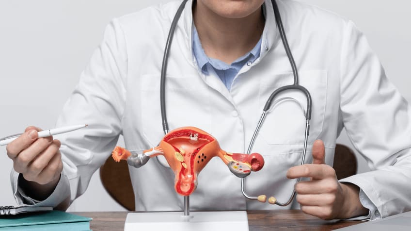 fibroids