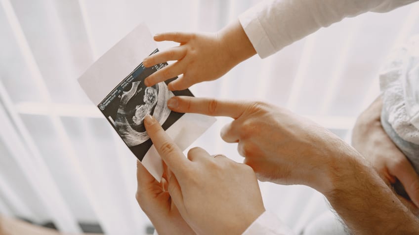 Fetal Scan