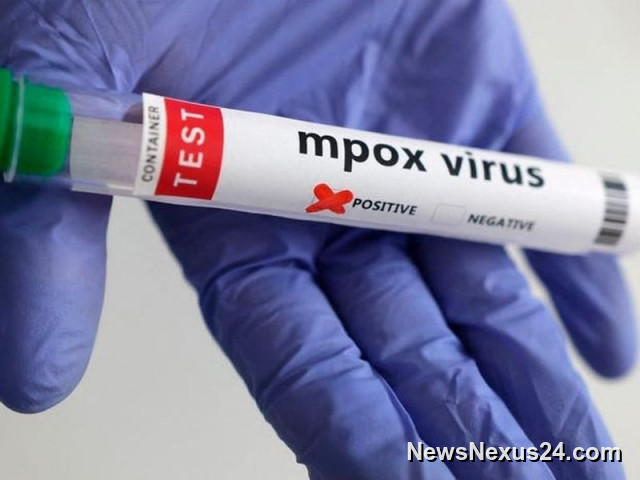 Sindh Mpox Cases Cross 100 as Authorities Tighten Surveillance