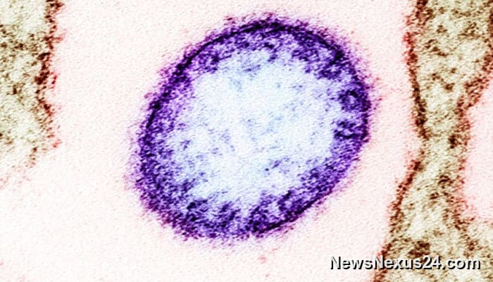 Nipah virus explained: risks, symptoms, and why experts aren’t panicking yet