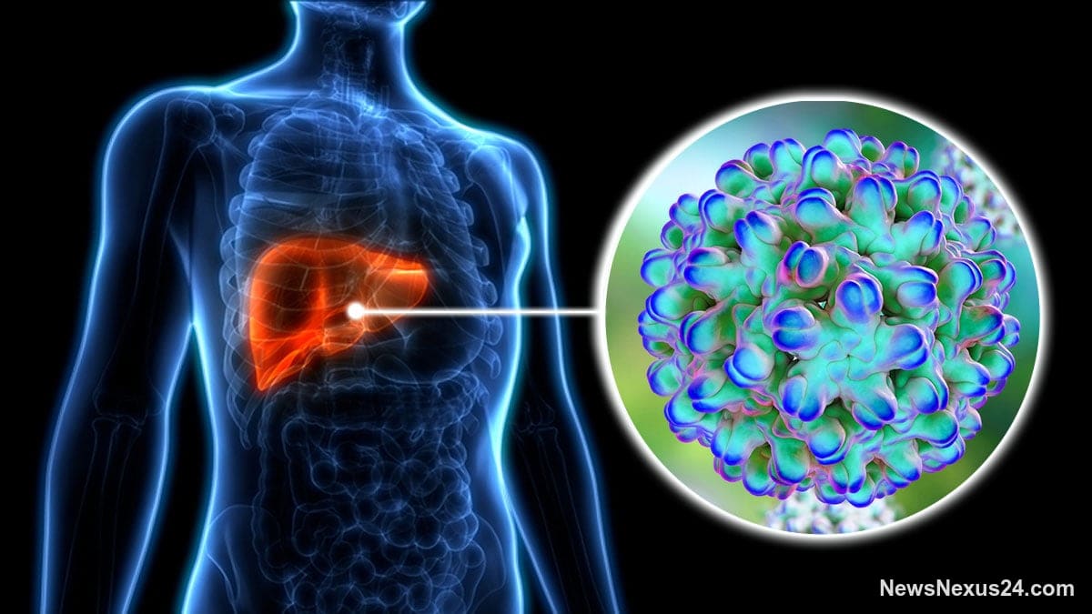 Pakistan Advances New Hepatitis Delta Therapy Access Plan
