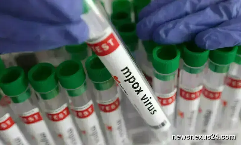 Karachi Reports New Mpox Case as Sindh Tally Climbs