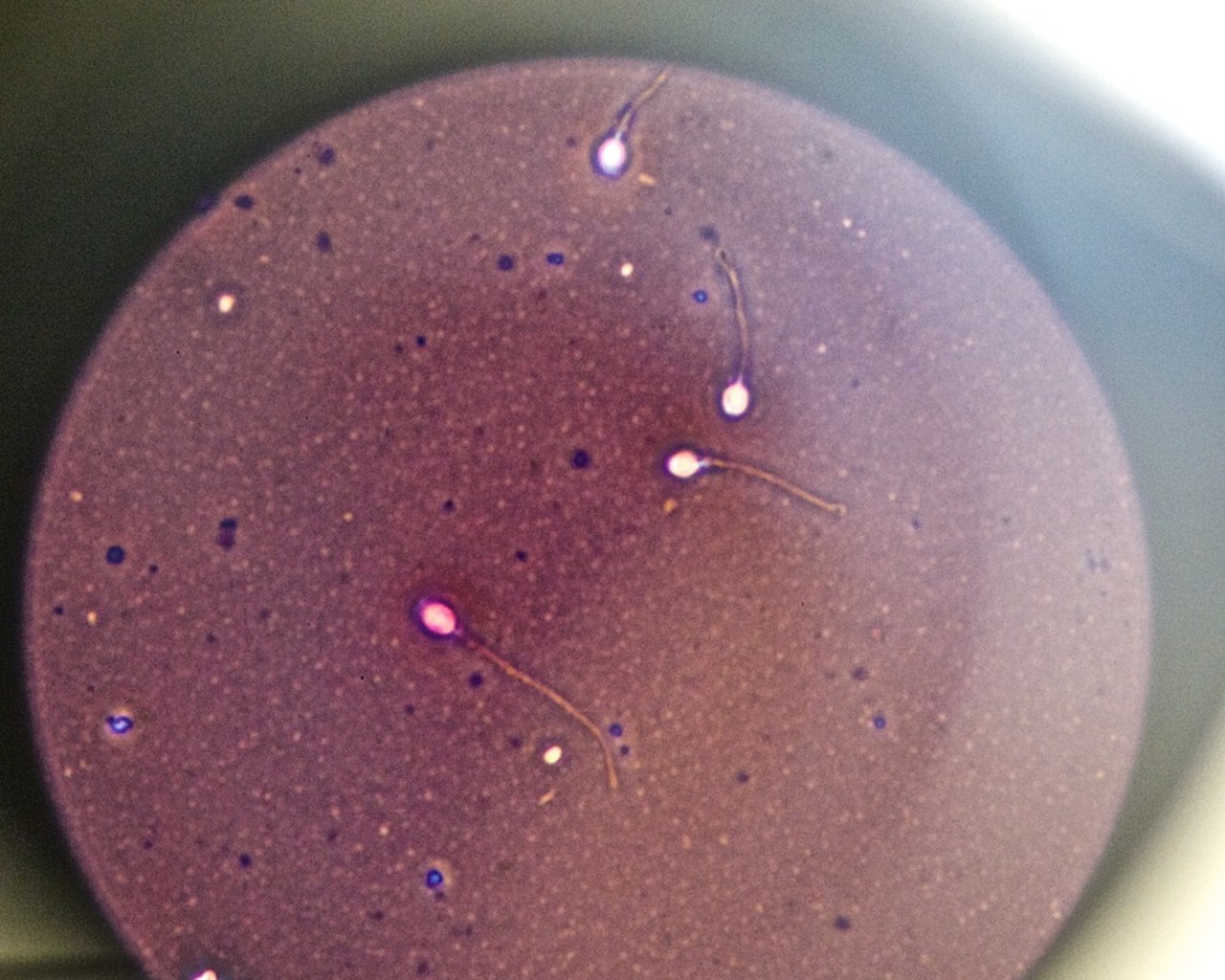 L'augmentation du nombre de donneurs de spermatozoïdes demeure insuffisante pour répondre à l'ensemble des projets parentaux dans des délais suffisants. (L. Souci/BSIP)
