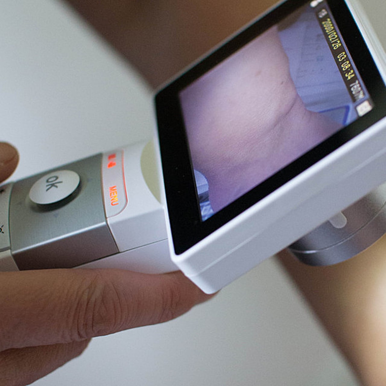 Parmi le matériel d'auscultation fourni avec le chariot de télémédecine mobile, le personnel d'Ehpad disposera d'une caméra avec embout dermatologique. Celui-ci permet de retransmettre au CH des détails de 4mm ou moins